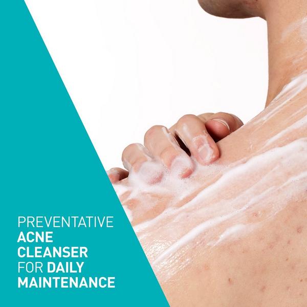 Acne Foaming Cream Cleanser with 4% BPO for Acne Prone Skin