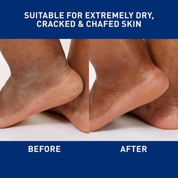 Healing Ointment to Help Protect & Soothe Dry to Very Dry Skin