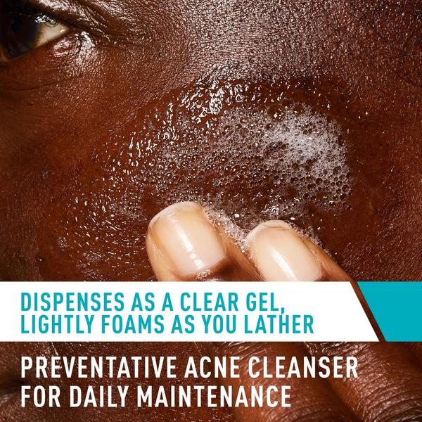 Acne Control Cleanser for Face with 2% Salicylic Acid & Purifying Clay for Oily Skin