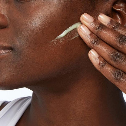 Resurfacing Retinol Facial Serum for Acne Prone Skin