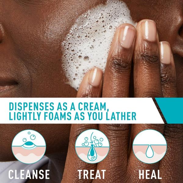 Acne Foaming Cream Cleanser with 4% BPO for Acne Prone Skin