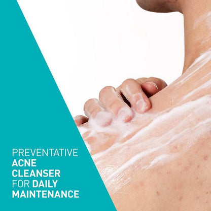 Acne Foaming Cream Cleanser with 4% BPO for Acne Prone Skin