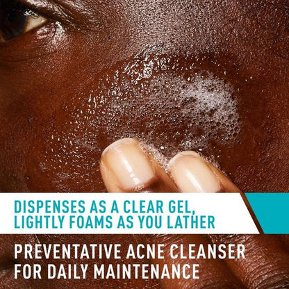 Acne Control Cleanser for Face with 2% Salicylic Acid & Purifying Clay for Oily Skin
