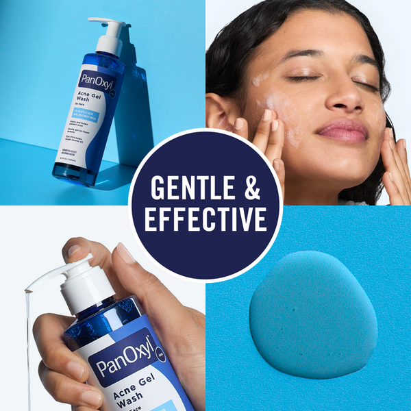 Acne Gel Wash for Face with Salicylic Acid
