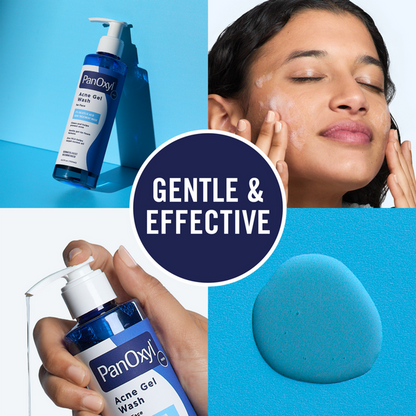 Acne Gel Wash for Face with Salicylic Acid